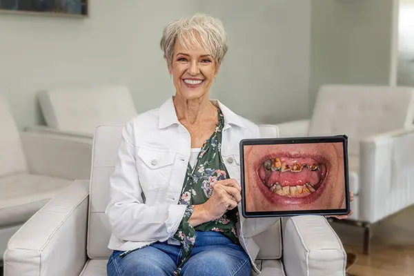 dental implants wagner