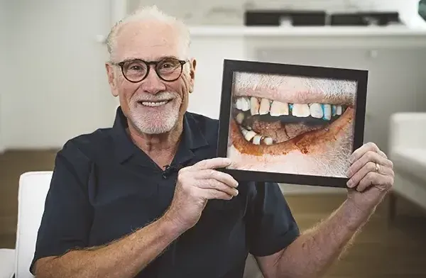 Wagner Center before after dental blog