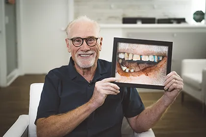 full mouth dental implants